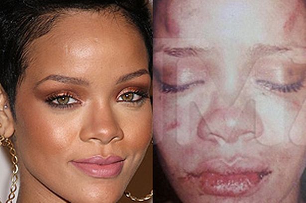 Chris Brown Emerges From Mansion After Hours-Long Standoff With LAPD Featured