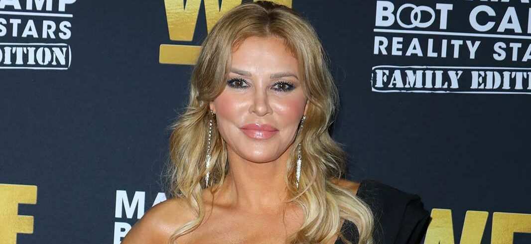 Brandi Glanville spent $70,000 treating facial disfigurement from suspected 'parasite'