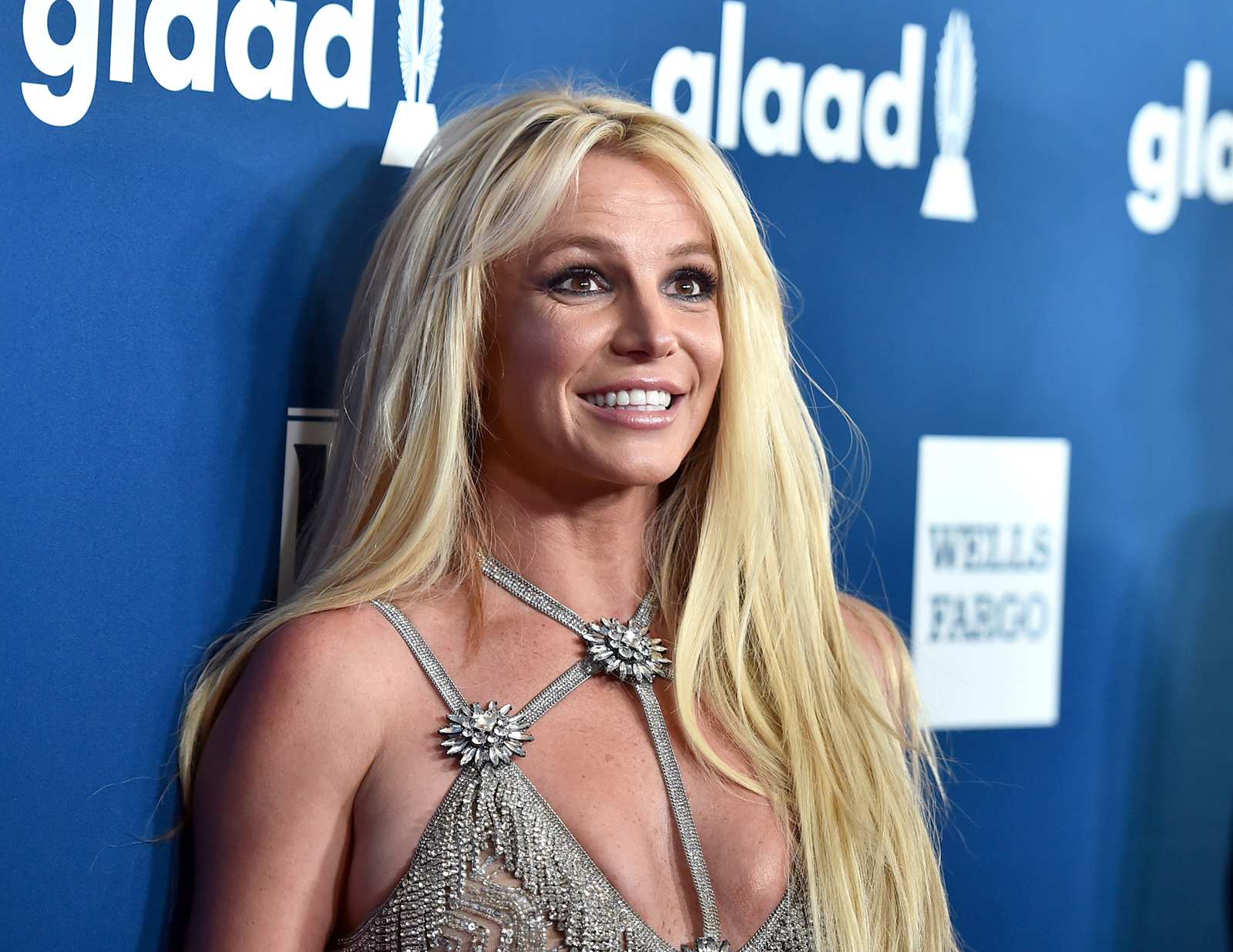 Britney Spears burned off hair, eyebrows in fireplace incident