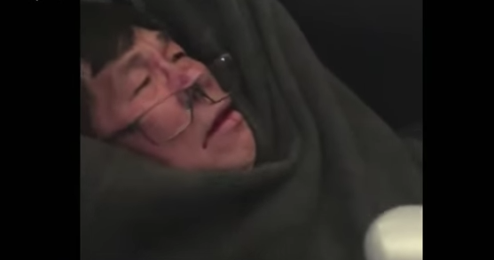 Passenger Dragged Off United Airlines Flight Suffered Broken Nose, Concussion, & Lost Two Front Teeth, Lawyer Says Featured