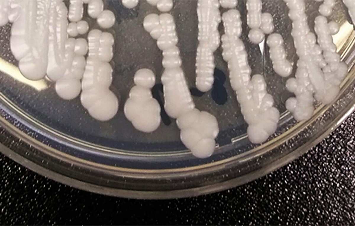 Fungus ‘superbug’ cases rise to highest levels in Nevada